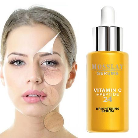 Get Glowing Skin with Our 10ml Vitamin C Facial Serum - Whitens, Brightens, Moisturizes, and More!