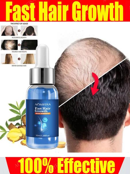 Effective Hair Growth Oil: Fast Baldness Repair, Hereditary Hair Loss, Postpartum Hair Loss, Seborrheic Hair, Anti-Hair Loss