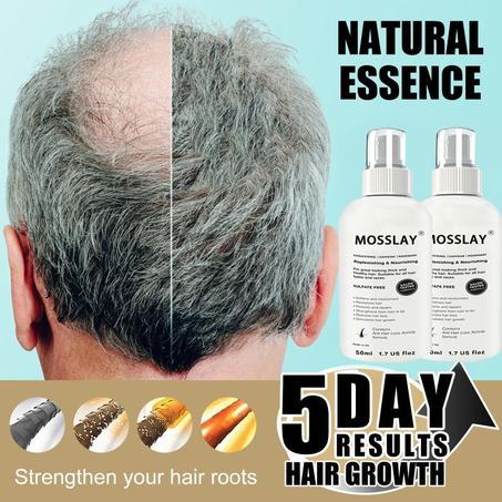 The New Formula Is Fresh and Not Greasy Hair Care Hair Growth Essence，Hair Growth Ingredients 5% Solve The Problem of Hair Loss