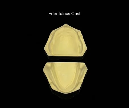 Edentulous cast