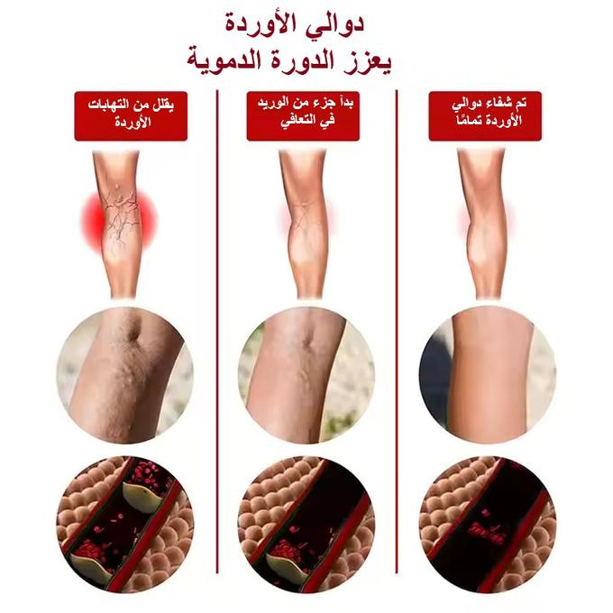 stores/96624f0672a913c06fbd23245cf2d69c/products/TZsUWwAdOypo0LLaHcH9ATEqti3aLpBQtyDZma2y.jpg