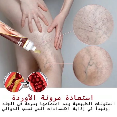 Varicose Veins Relief Cream