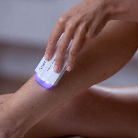 جهاز YEES لإزالة الشعر.