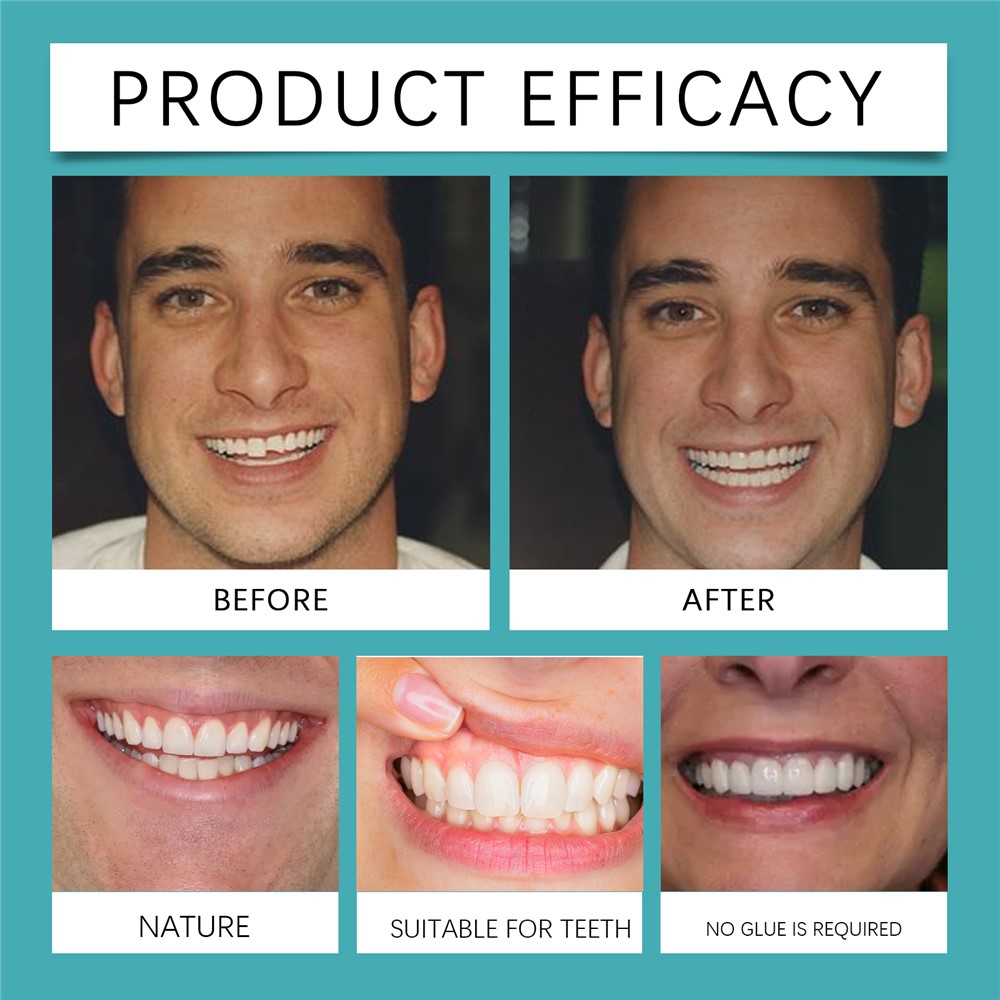 ابتسامة إيهو المفاجئة