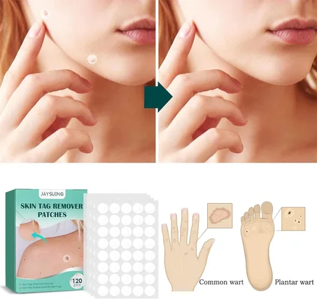لاصقات لإزالة الزوائد الجلدية