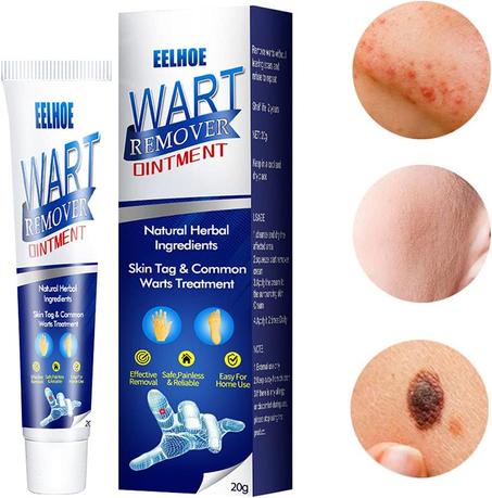 Gel Éliminateur de Verrues