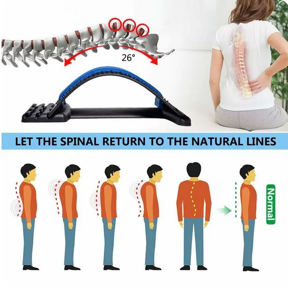 جهاز تمدد للظهر