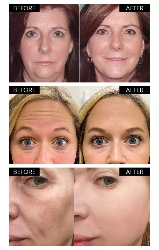 سيروم مضاد للتجاعيد