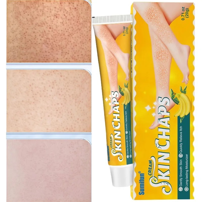 كريم مضاد للتشققات