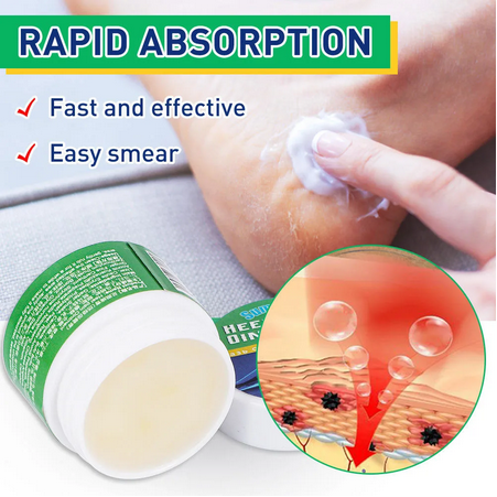 مرهم آلام الكعب