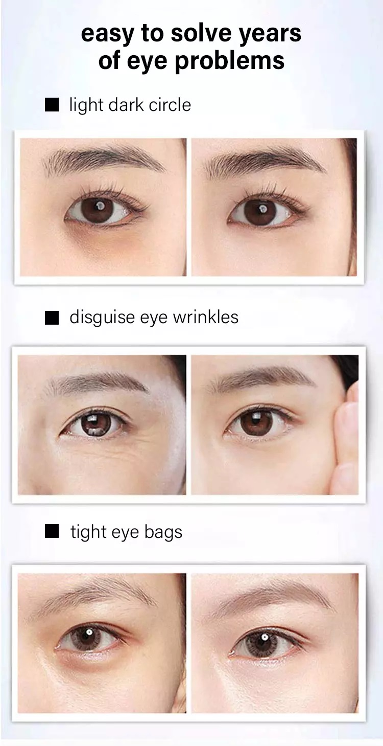 كريم لشد العين