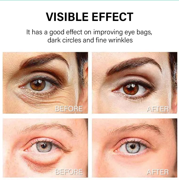 كريم لشد العين