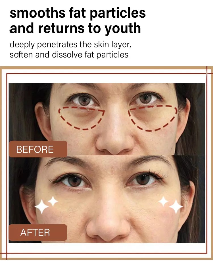 كريم لشد العين