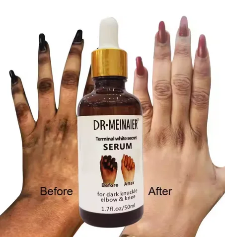 سيروم إزالة المناطق الداكنة