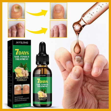 Aceite de Tratamiento de Uñas con Jengibre