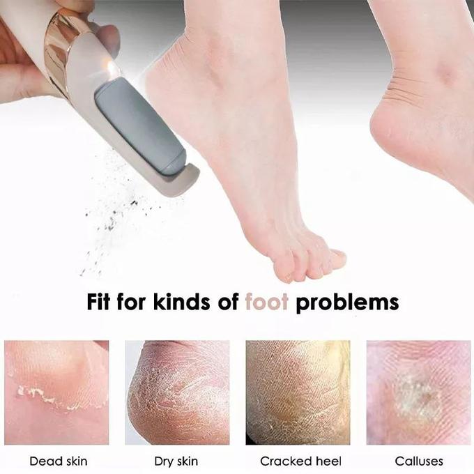 stores/9833dbe0ed2864e1febf7c866484706b/products/vrStIEWXNSjMGk00xq1UdRRNKsvms1eqsm7HQx2Y.jpeg