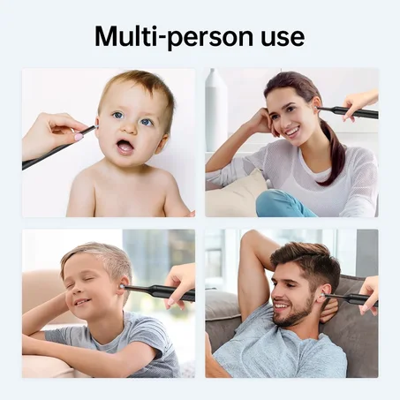 جهاز تنظيف  الأذن بكاميرا HD