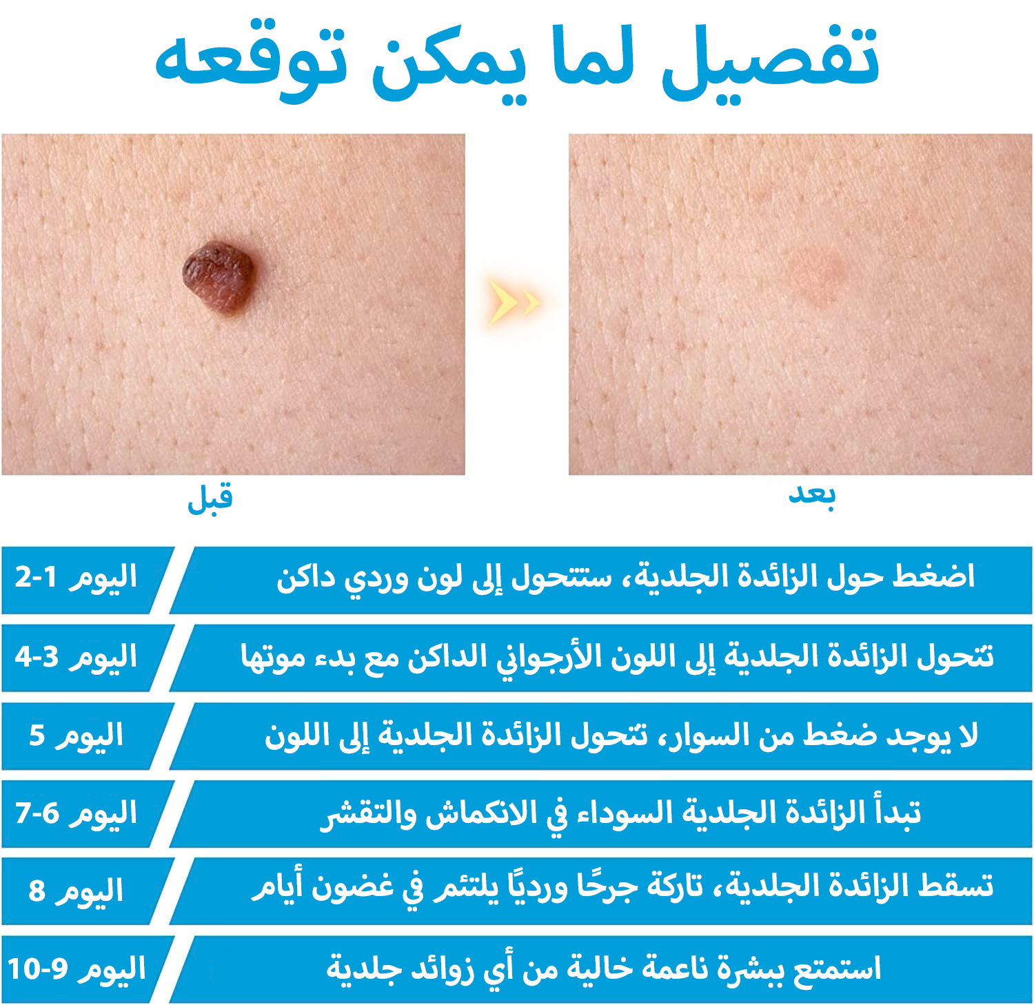 مزيل علامات البشرة