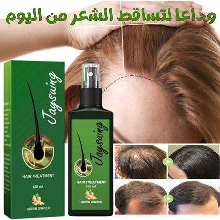 بخاخ الزنجبيل الأخضر ضد تساقط الشعر للرجال والنساء الأكثر طلباً في العالم1