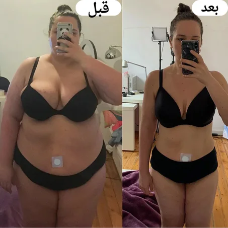 رقعة التخسيس المثالية للتخلص من السموم تحتوي على30 رقعة (خصم 50%لفترة محدودة 🔥 )