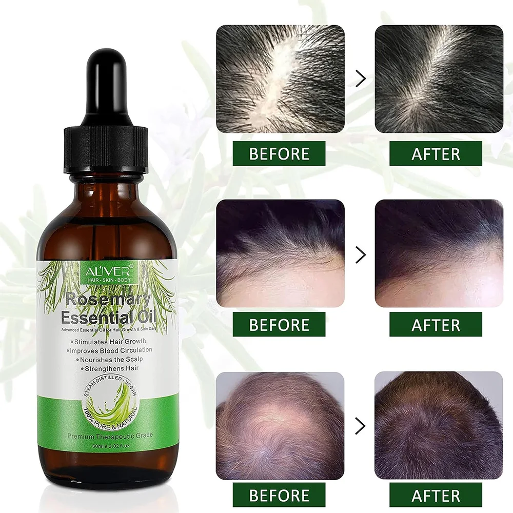 زيت أكليل الجبل لنمو الشعر - Growth Hair Rosemary Essential Oil