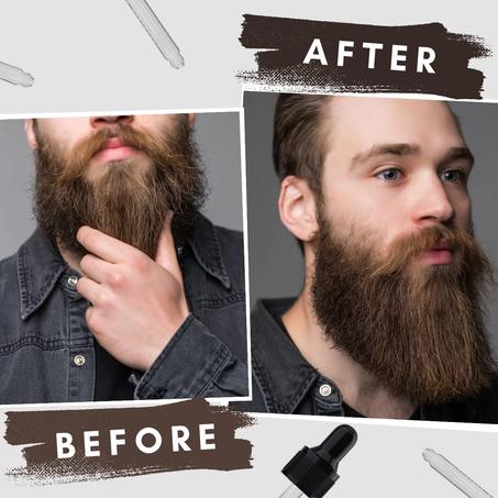 Beard Growth Oil