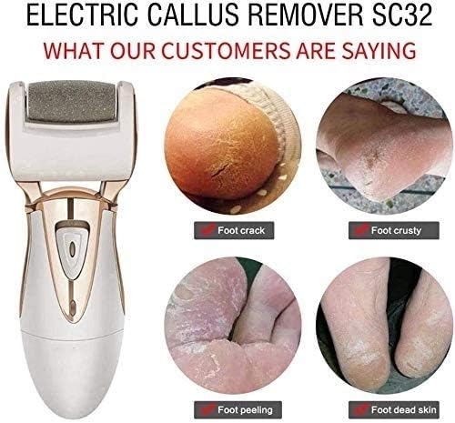 Electric Callus Remover