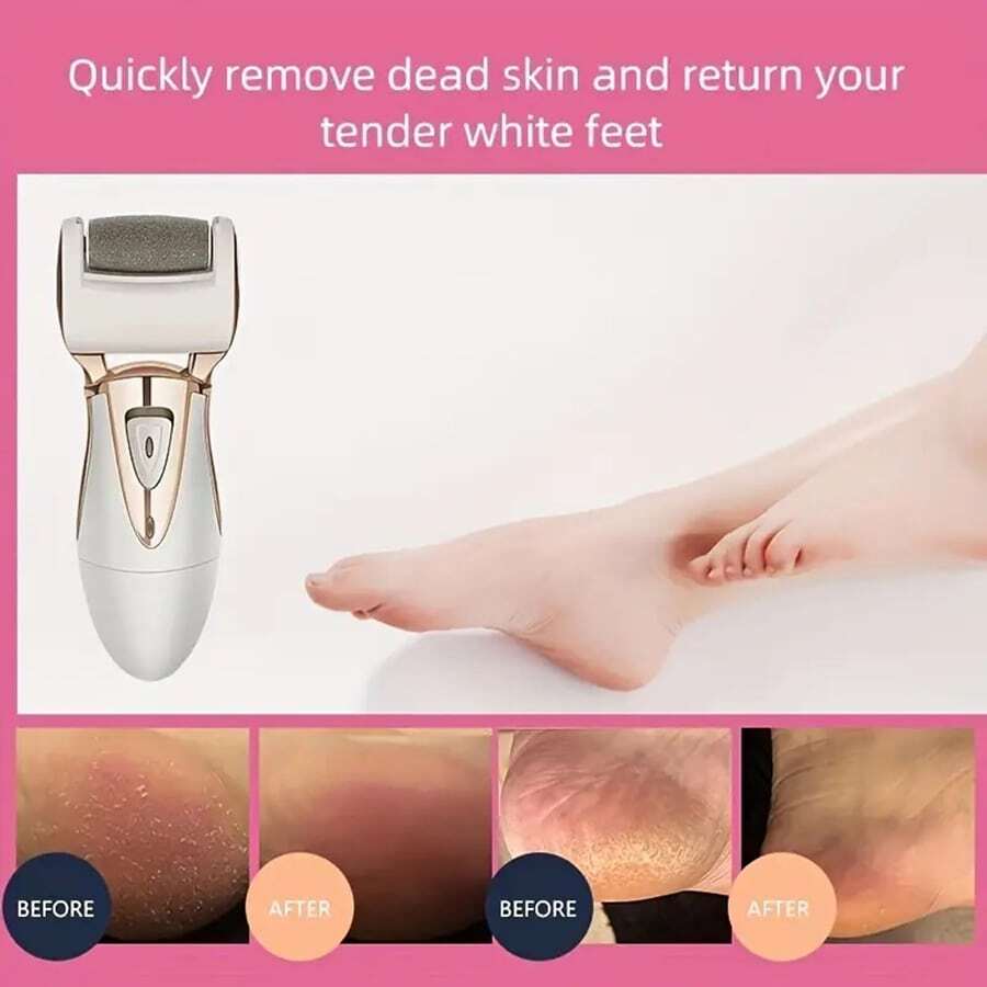 Electric Callus Remover