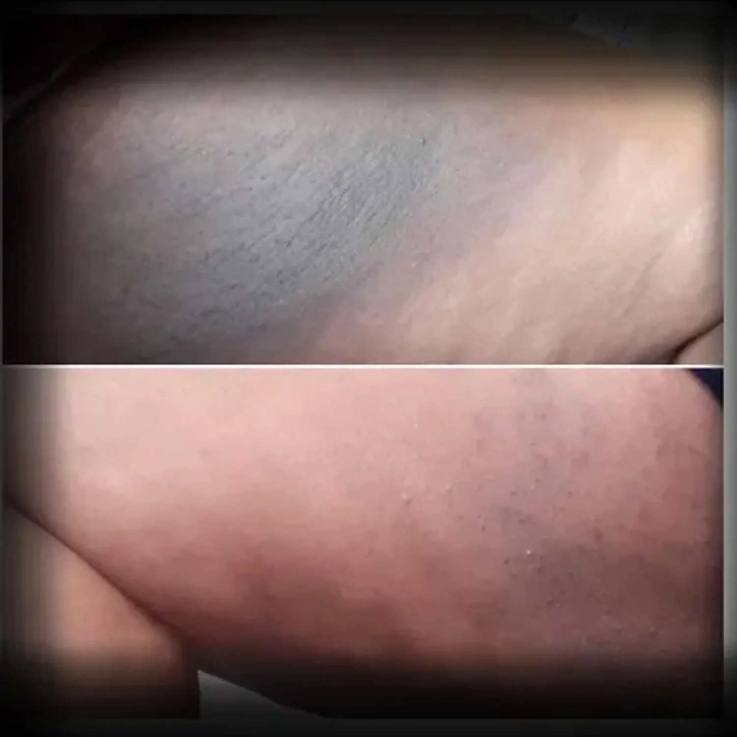 Dites Adieu aux Entrecuisses Noirs Grâce au Pouvoir des Plantes Africaines ! 🌿✨