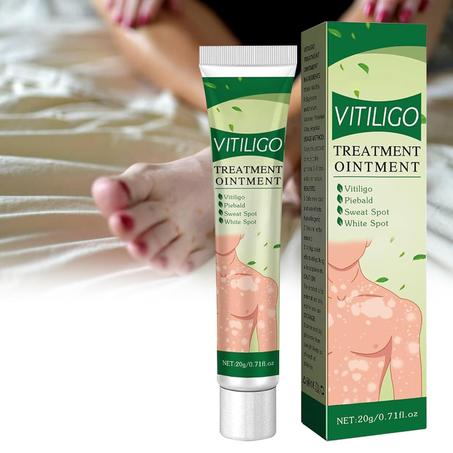 Eelhoe Vitiligo Cream - كريم إيلهو لعلاج البهاق