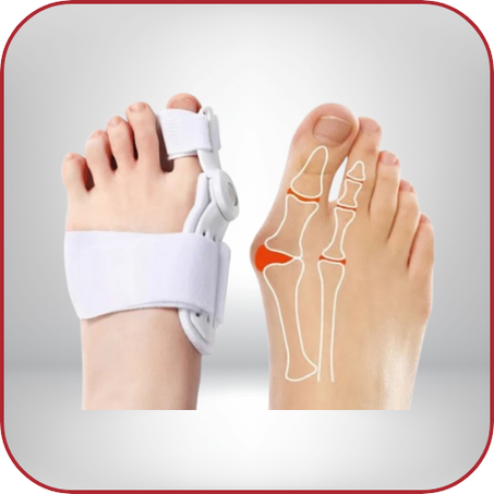 إعوجاج إبهام القدم