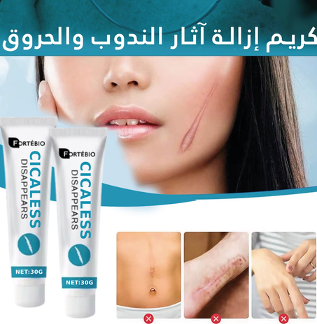 كريم إزالة ٱثار الجروح والحروق