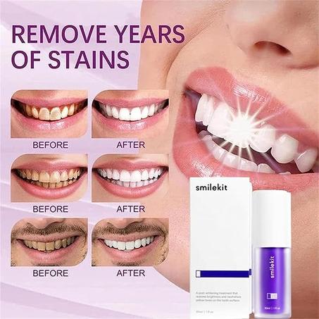 Whitening Foam Toothpaste