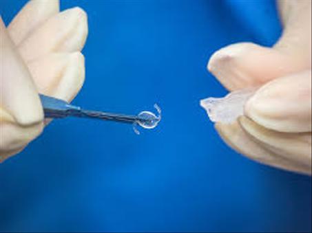 IMPLANTS Pliable Baush Lomb Akreos