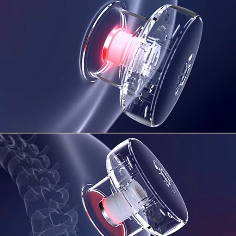 مدلك الحجامة الحديث - Cupping Therapy