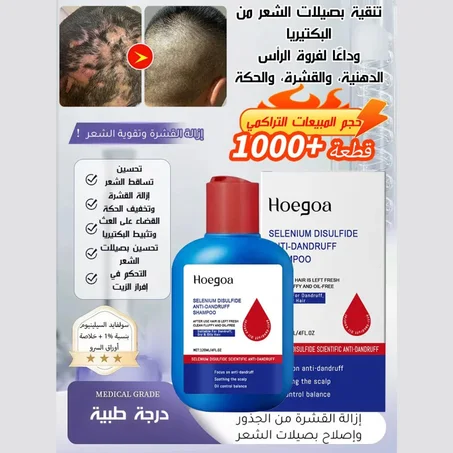 【التخلص من سعفة فروة الرأس العنيدة في 3 أسابيع】شامبو طبي مضاد للبكتيريا والعث