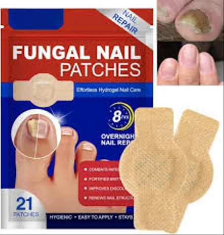 علاج لصقات الأظافر الفطرية
