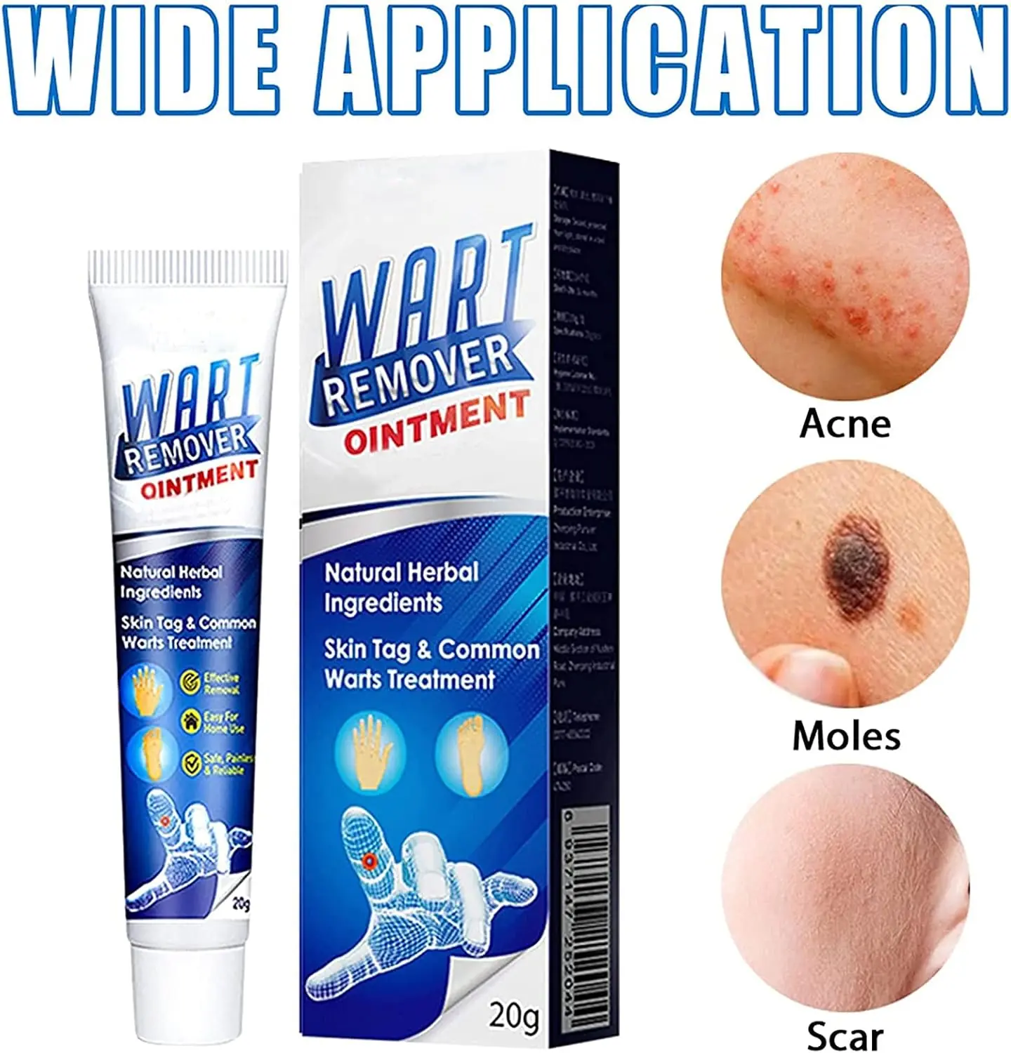 كريم فعّال، آمن، وطبيعي لإزالة الثآليل والزوائد الجلدية بسرعة