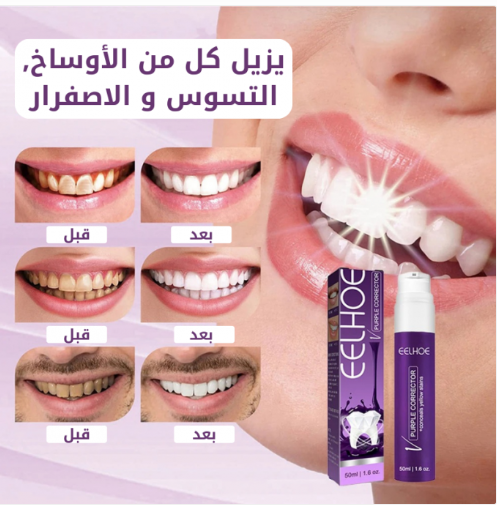 stores/9ee47d6d50749f12c8d8ab344059a0f8/products/U72s1hVyr1Q2dxq8y4kA5S3oXzURi953M5xyfAxz.png