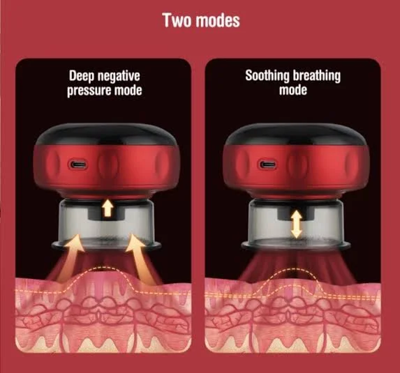 Cupping Therapy Massager