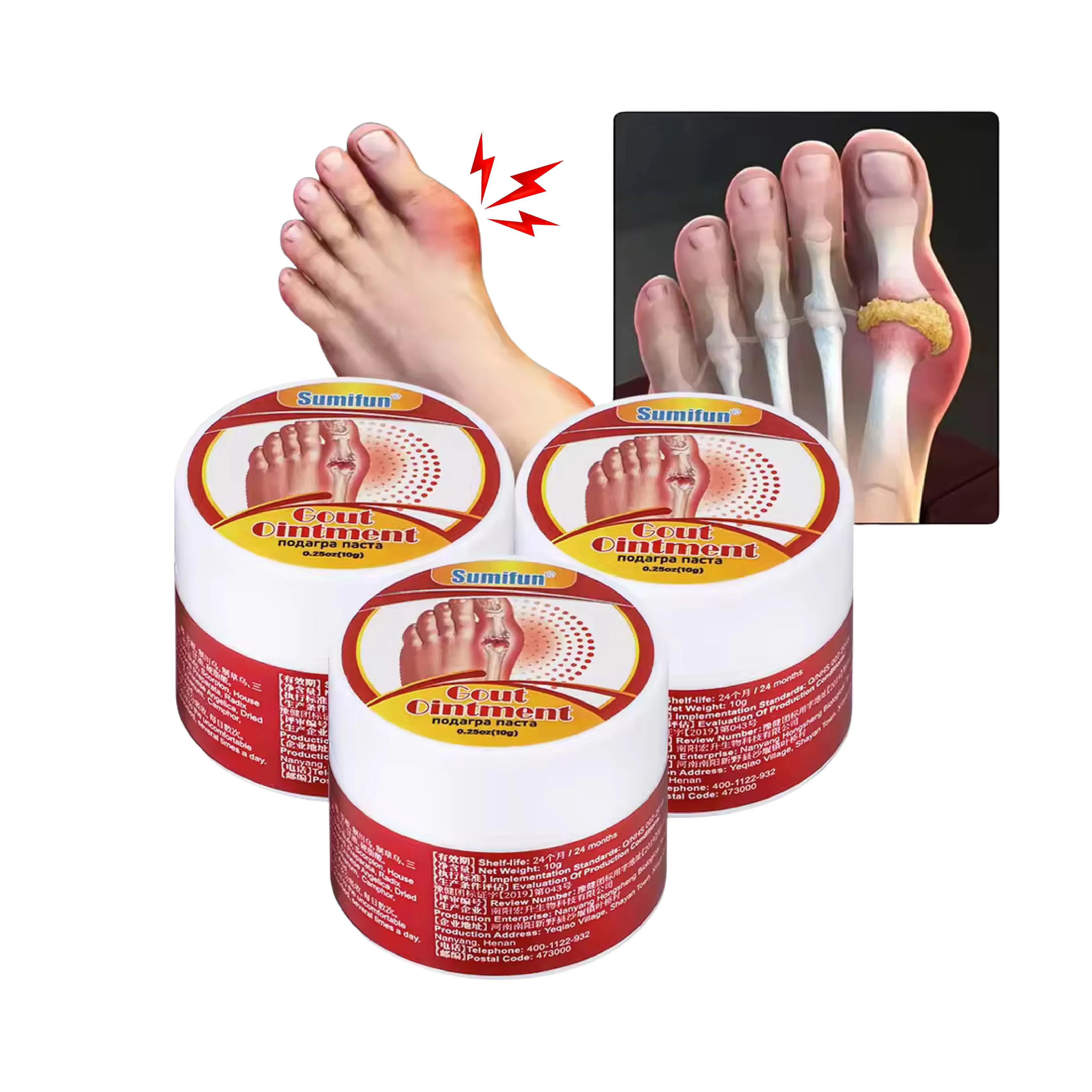 كريم لعلاج النقرس وألم المفاصل اليد والركبة والأرجل