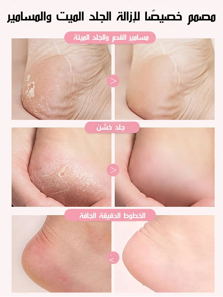 مبرد القدم الكهربائي المتطور | نعومة فورية في 3 دقائق