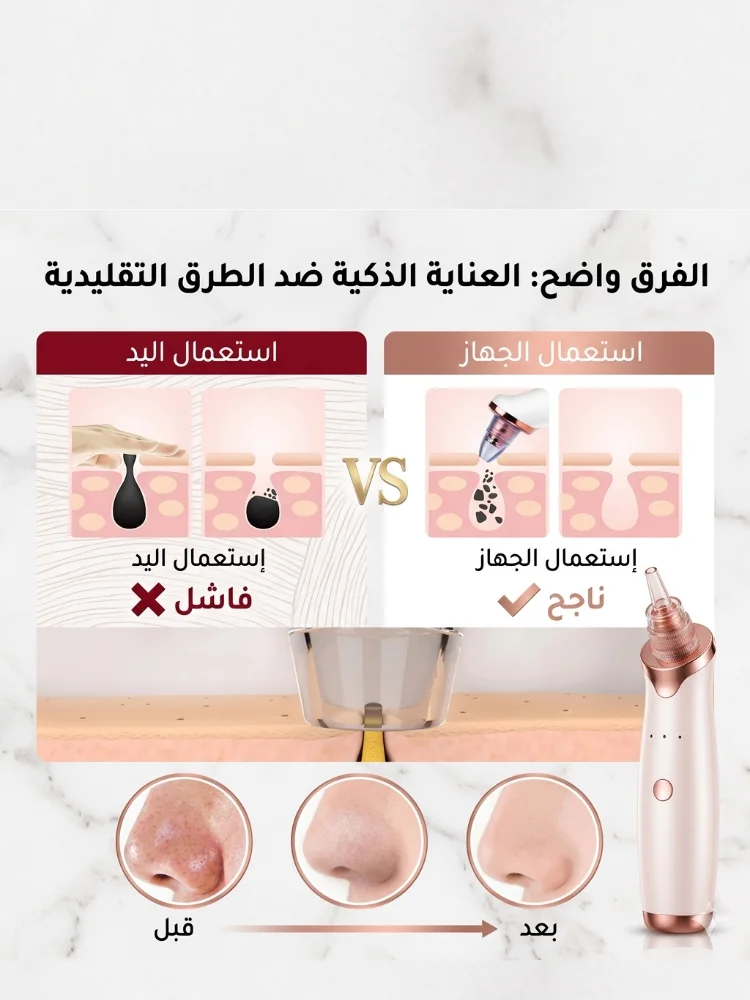 جهاز تنظيف المسام الذكي✨