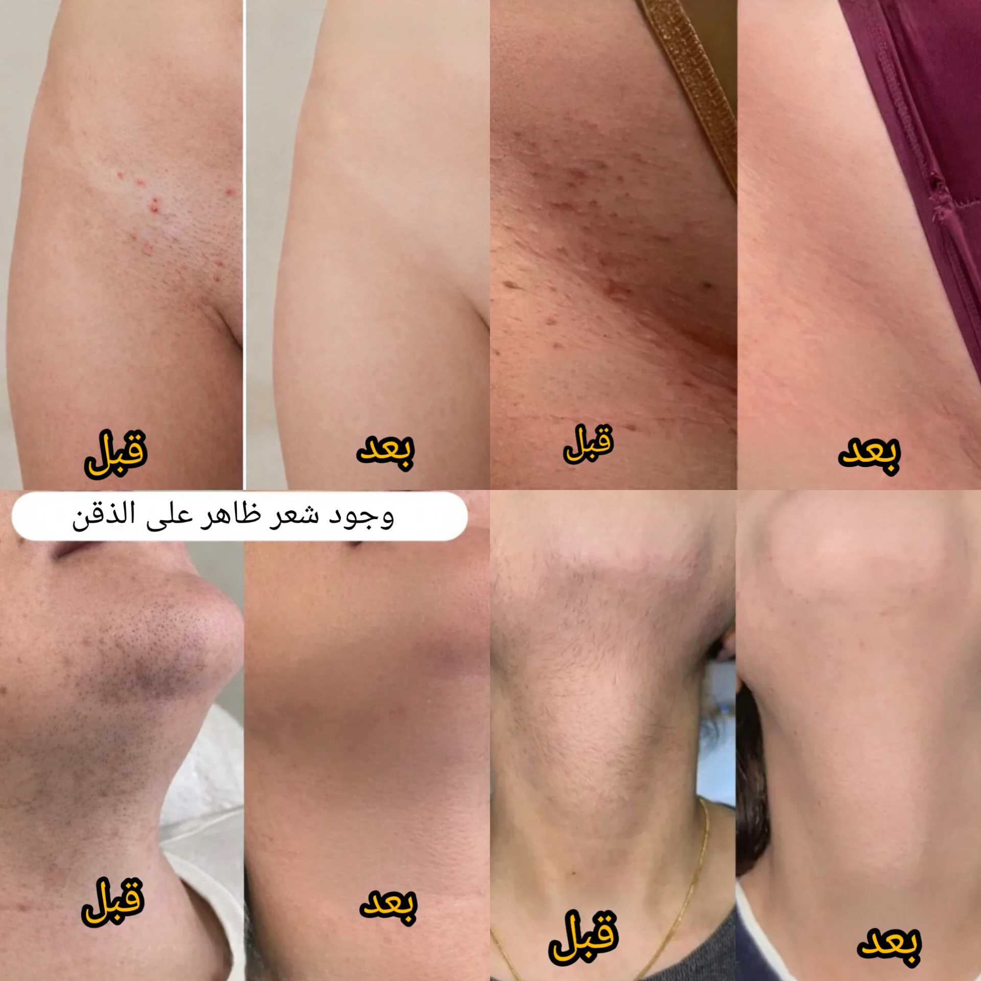 جهاز الحلاقه مزدوج الرأس ــ للنساء والرجال Pu2OkqXDsdAHCyLr7iz6jyl0bxflQwV41LRK9BhB