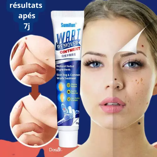 Crème Anti-Verrues
