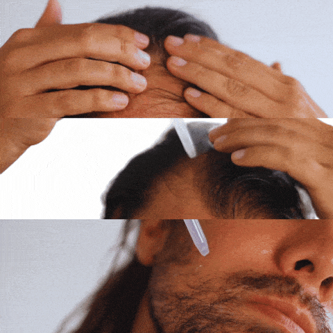 سيروم إعادة نمو الشعر