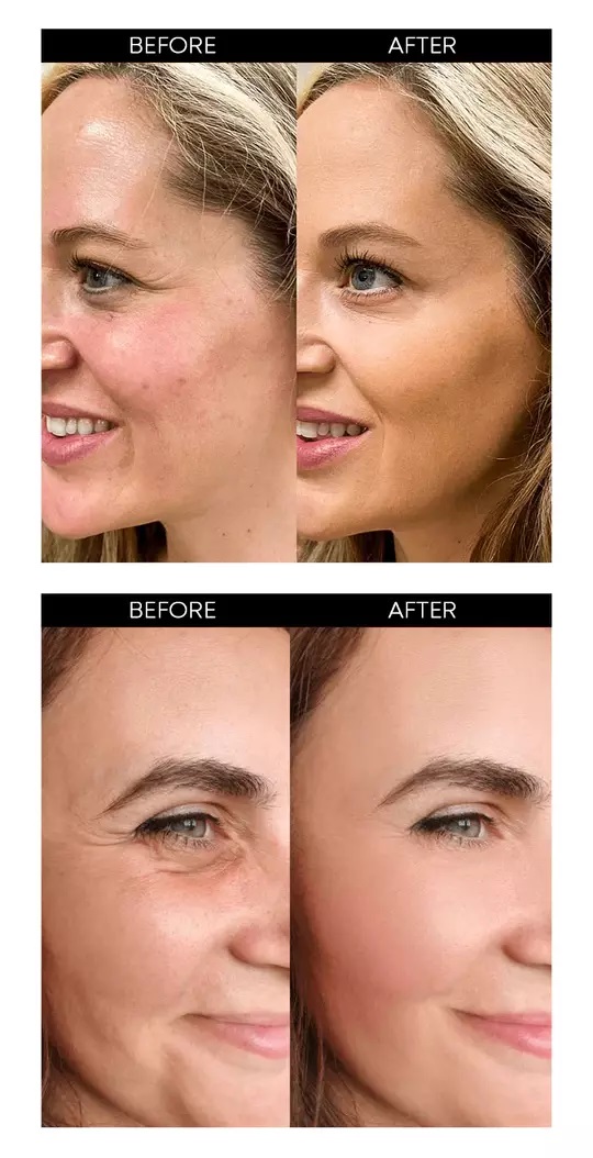 Collagen مجموعة سيروم الوجه