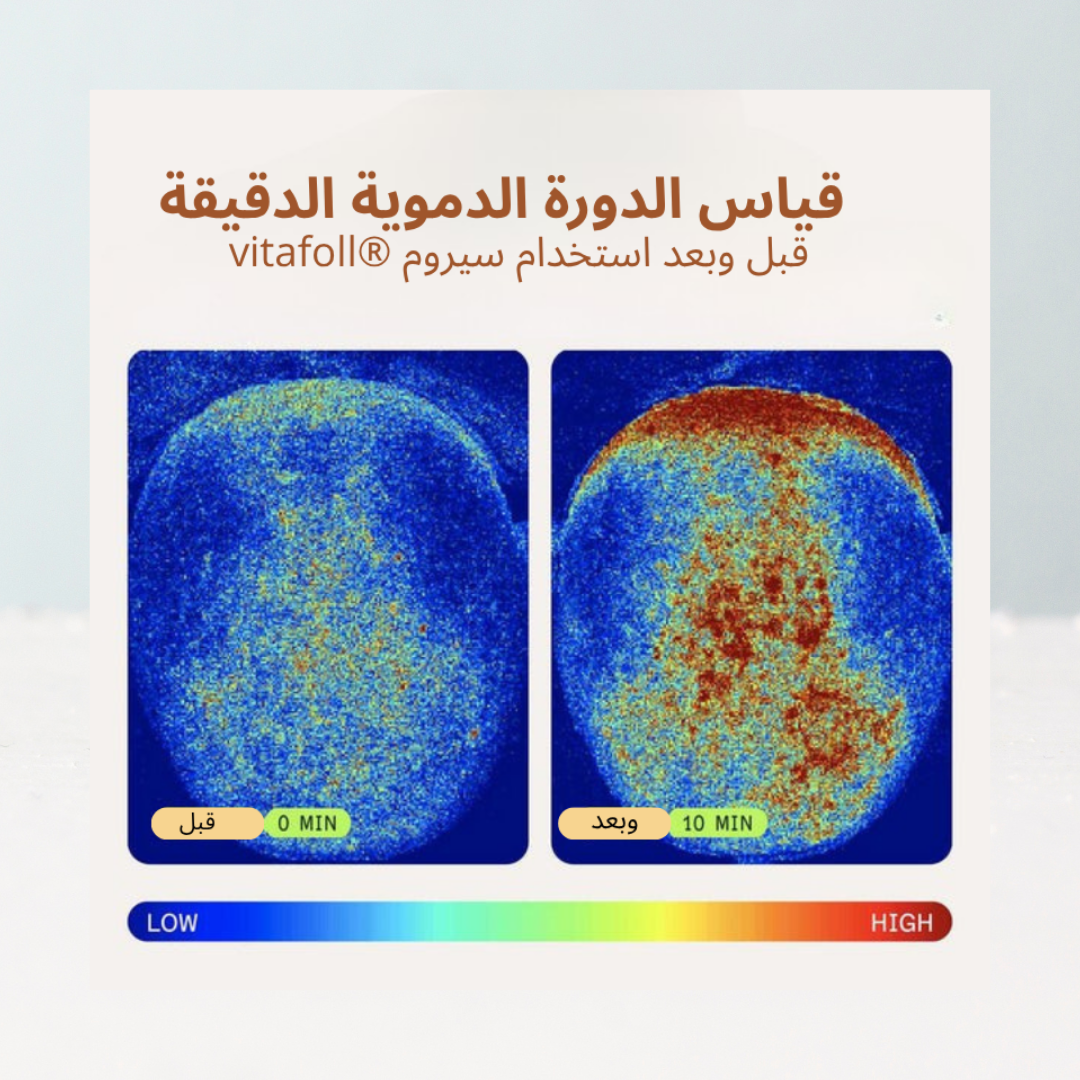 سيروم إعادة نمو الشعر
