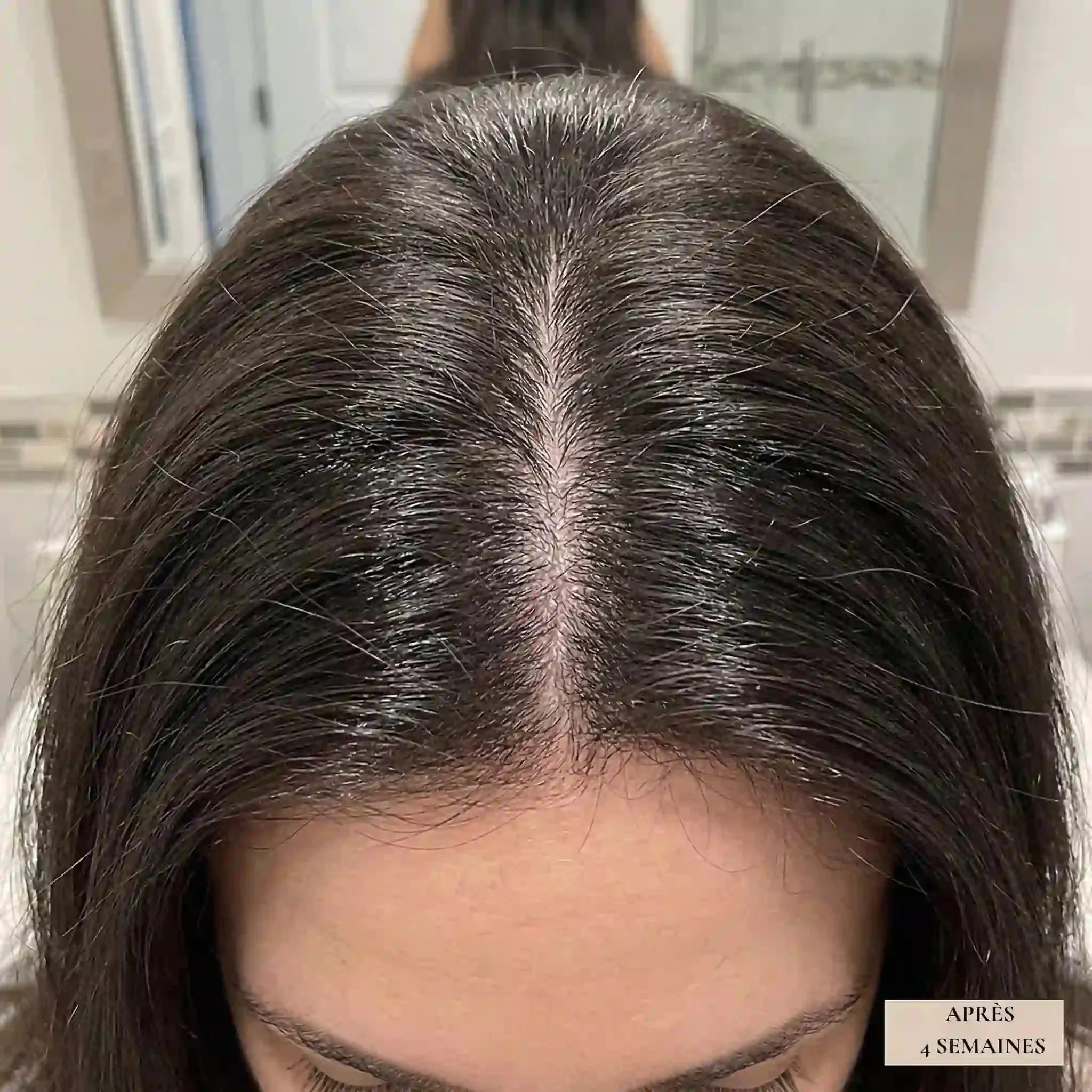 Huile Anti-Chute BELVORN – 60ml