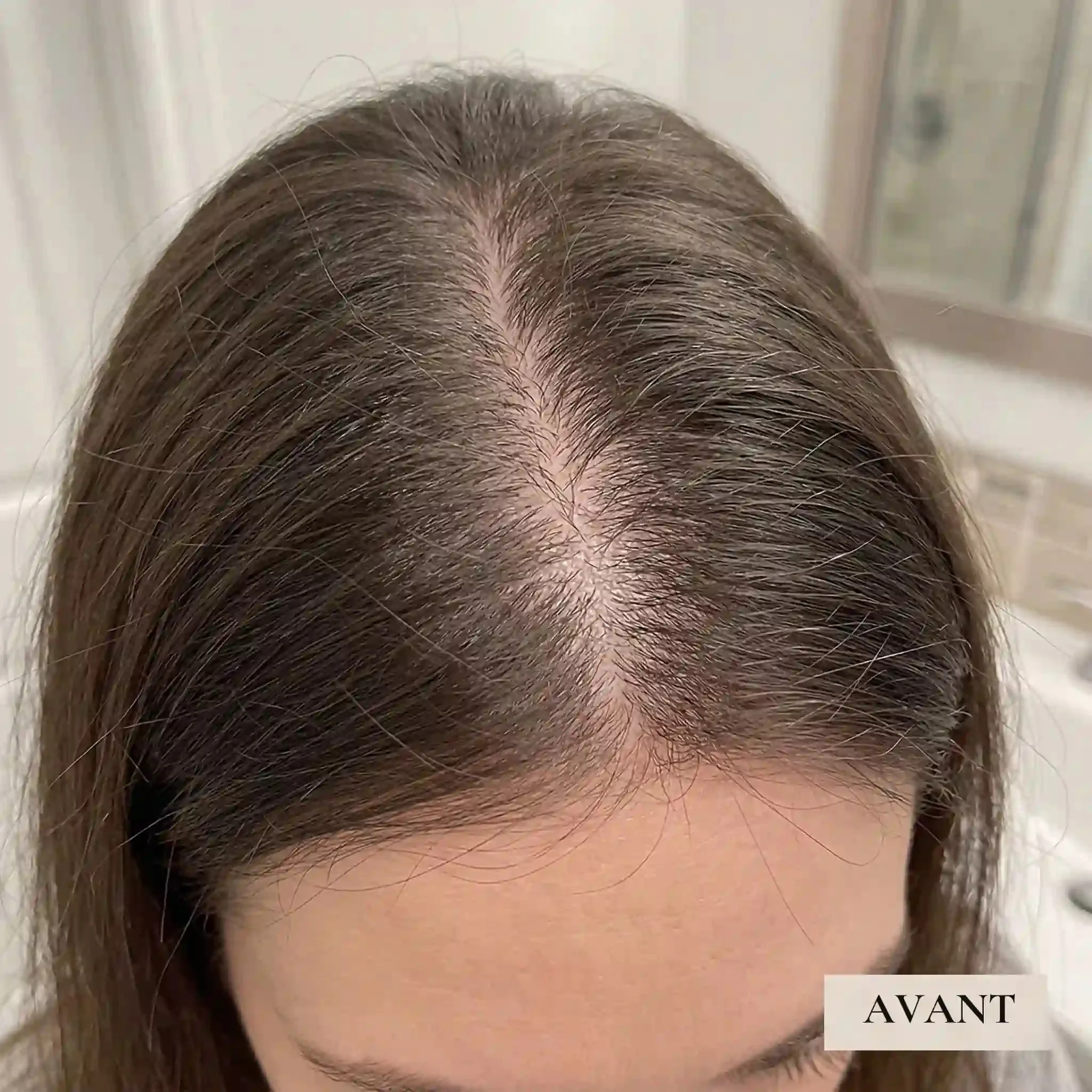 Huile Anti-Chute BELVORN – 60ml